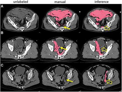Accelerating voxelwise annotation of cross-sectional imaging through AI collaborative labeling with quality assurance and bias mitigation